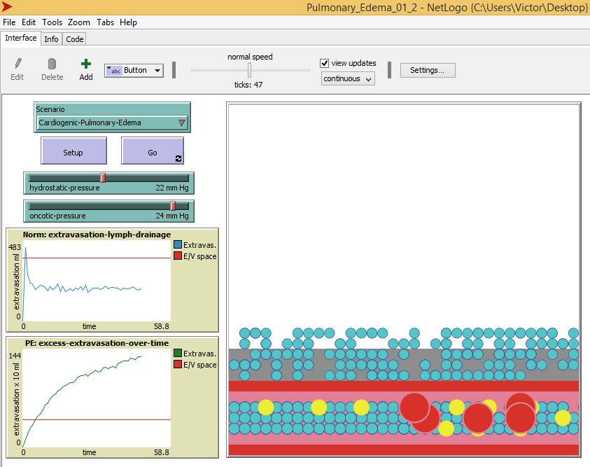 Pulmonary_Edema_01_2 preview image