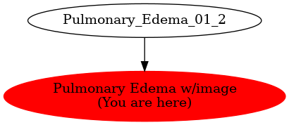 Graph of models related to 'Pulmonary Edema w/image' 